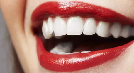 Diş Estetiği (Hollywood Smile) Tedavileri|livaclinic